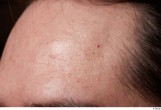 HD Face Skin Kevin Sarmiento face forehead skin pores skin…